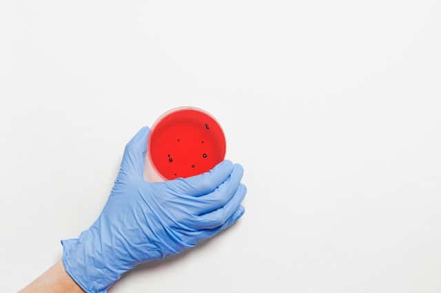 313 новых случаев COVID-19 выявлено в Свердловской области. + 1 в Шале